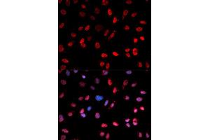 Immunofluorescence analysis of MCF-7 cells using Phospho-ATF2-T71 antibody (ABIN5969881). (ATF2 Antikörper  (pThr53))
