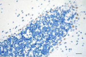 Immunohistochemistry was performed on paraffin-embedded mouse brain using SMARCA4 antibody (ABIN7800476), 1:200).