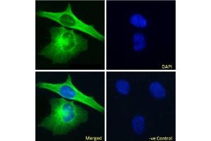 Immunofluoresence staining of fixed HeLa cells with anti-Alpha-tubulin antibody F2C. (Rekombinanter alpha Tubulin Antikörper)