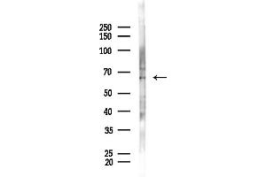Western blot analysis of lysates from F10-LUC cells(starvation,24h treatment), using GRK6 Antibody at 1/1000 dilution.