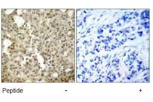 Image no. 1 for anti-Protein Kinase C, delta (PKCd) (AA 643-647) antibody (ABIN197565) (PKC delta Antikörper  (AA 643-647))