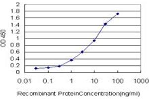 Detection limit for recombinant GST tagged DPYD is approximately 0. (DPYD Antikörper  (AA 1-110))