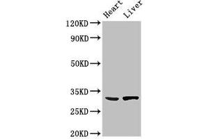 Western Blot Positive WB detected in: Mouse heart tissue, Rat liver tissue All lanes: SDCBP antibody at 3 μg/mL Secondary Goat polyclonal to rabbit IgG at 1/50000 dilution Predicted band size: 33, 32 kDa Observed band size: 33 kDa (SDCBP Antikörper  (AA 21-228))