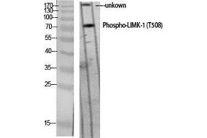 Western Blot (WB) analysis of specific cells using Phospho-LIMK-1 (T508) Polyclonal Antibody. (LIM Domain Kinase 1 Antikörper  (pThr508))