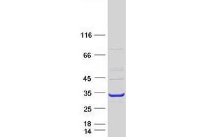 Adenylate Kinase 4 (AK4) (Transcript Variant 5) protein (Myc-DYKDDDDK Tag)