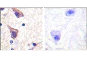Immunohistochemistry analysis of paraffin-embedded human brain tissue, using TGF beta Receptor II (Ab-250) Antibody. (TGFBR2 Antikörper  (AA 191-240))