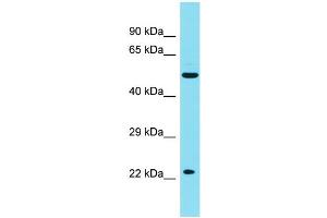 Host:  Rabbit  Target Name:  PHF15  Sample Type:  Liver Tumor lysates  Antibody Dilution:  1. (PHF15 Antikörper  (N-Term))