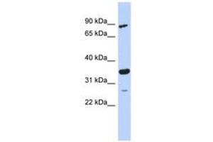 Image no. 1 for anti-PDLIM1 Interacting Kinase 1 Like (PDIK1L) (AA 179-228) antibody (ABIN6743713) (PDIK1L Antikörper  (AA 179-228))