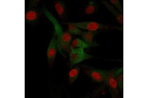 Immunofluorescence (IF) image for anti-CD68 Molecule (CD68) antibody (ABIN6941241)