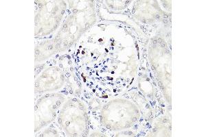 Immunohistochemistry (IHC) image for anti-Wilms Tumor 1 (WT1) antibody (ABIN7271368)