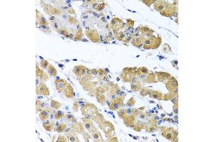 Immunohistochemistry of paraffin-embedded human stomach using OGFR antibody (ABIN6128395, ABIN6145006, ABIN6145007 and ABIN6222871) at dilution of 1:100 (40x lens). (OGFR Antikörper  (AA 1-280))