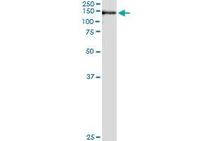 Immunoprecipitation (IP) image for anti-Ubiquitin Specific Peptidase 33 (USP33) (AA 327-426) antibody (ABIN564991)