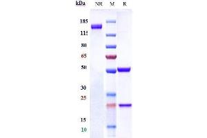 anti-CEACAM6 (Tinurilimab Biosimilar) antibody