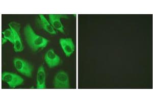 Immunofluorescence analysis of HeLa cells, using Kir5. (KIR5.1 Antikörper  (Ser416))