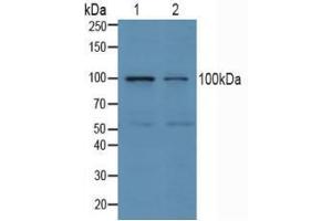 Western blot analysis of (1) Human Jurkat Cells and (2) Human K562 Cells. (ube3a Antikörper  (AA 158-407))