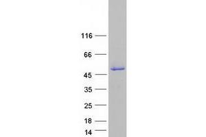 Western Blotting (WB) image for Single Stranded DNA Binding Protein 4 (SSBP4) (Transcript Variant 2) protein (Myc-DYKDDDDK Tag) (ABIN2732695)
