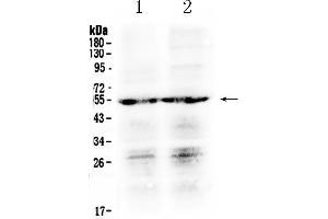 Western blot analysis of PTGER4 using anti- PTGER4 antibody .