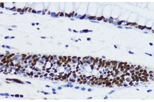 Immunohistochemistry of paraffin-embedded Human colon using Acetyl-Histone H2B-K12 Polyclonal Antibody at dilution of 1:200 (40x lens).