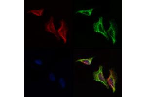 ABIN6258206 and ABIN6274351 staining Hela cells by IF/ICC. (GIT2 Antikörper  (Internal Region))