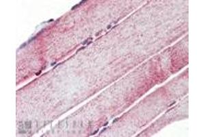 Immunohistochemistry analysis of human skeletal muscle tissue stained with Mn SOD, pAb at 10 μg/mL. (SOD2 Antikörper)
