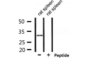 Western blot analysis of extracts from rat spleen, using SMUG1 Antibody. (SMUG1 Antikörper  (Internal Region))