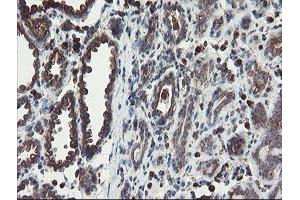 Immunohistochemical staining of paraffin-embedded Human breast tissue using anti-ACBD3 mouse monoclonal antibody. (ACBD3 Antikörper)