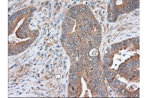 Immunohistochemical staining of paraffin-embedded Human prostate tissue using anti-SNX9 mouse monoclonal antibody. (SNX9 Antikörper)