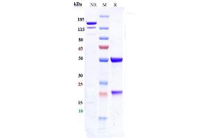 Anti-ICAM1 / CD54 Reference Antibody (bersanlimab) on SDS-PAGE under reducing (R) condition. (Rekombinanter ICAM1 (Bersanlimab Biosimilar) Antikörper)