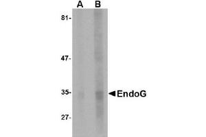 Western Blotting (WB) image for anti-Endonuclease G (ENDOG) (AA 51-140) antibody (ABIN492523) (Endonuclease G Antikörper  (AA 51-140))