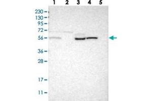Western blot analysis of Lane 1: RT-4, Lane 2: U-251 MG, Lane 3: Human Plasma, Lane 4: Liver, Lane 5: Tonsil with PIEZO2 polyclonal antibody . (PIEZO2 Antikörper)