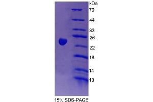 SDS-PAGE analysis of Human Vav 3 Oncogene Protein. (VAV3 Protein)