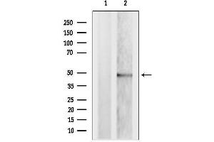 Western blot analysis of lysates from MCF7, using TRBP Antibody. (TRBP Antikörper  (Internal Region))