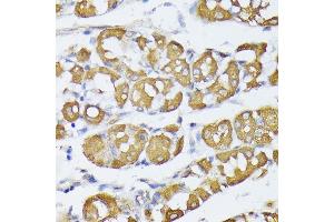 Immunohistochemistry of paraffin-embedded human stomach using VAPA antibody (ABIN6132892, ABIN6150056, ABIN6150057 and ABIN6216758) at dilution of 1:100 (40x lens). (VAPA Antikörper  (AA 137-227))