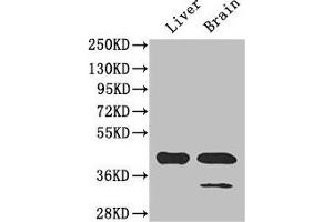 Western Blot Positive WB detected in: Mouse liver tissue, Mouse brain tissue All lanes: GLUL antibody at 3 μg/mL Secondary Goat polyclonal to rabbit IgG at 1/50000 dilution Predicted band size: 42 kDa Observed band size: 42 kDa (GLUL Antikörper  (AA 86-373))