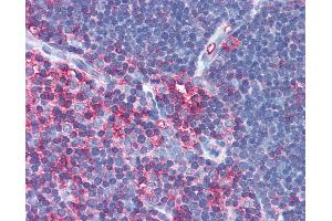 Anti-MSN / Moesin antibody IHC of human thymus. (Moesin Antikörper)