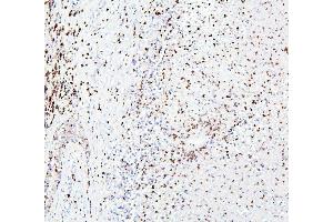IHC analysis of CRB1 using anti-CRB1 antibody (ABIN6719658).