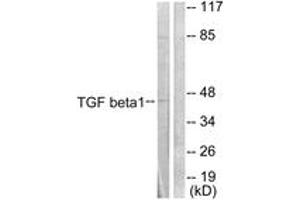 Western blot analysis of extracts from HepG2 cells, using TGF beta1 Antibody. (TGFB1 Antikörper  (AA 336-385))