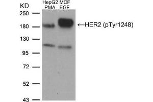 Western blot analysis of extracts from HepG2 cells treated with PMA and MCF cells treated with EGF, using HER2 (Phospho-Tyr1248) Antibody. (ErbB2/Her2 Antikörper  (pTyr1248))