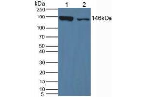 Western blot analysis of (1) Mouse Liver Tissue and (2) Mouse Lung Tissue. (XDH Antikörper  (AA 231-416))