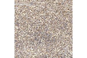 IHC analysis of SNRNP27 using anti-SNRNP27 antibody (ABIN7599614). (SNRNP27 Antikörper  (AA 100-155))