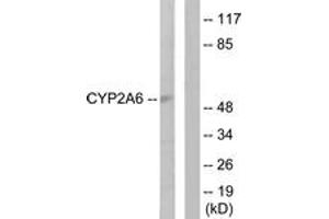 Western blot analysis of extracts from Jurkat cells, using Cytochrome P450 2A6 Antibody. (CYP2A6 Antikörper  (AA 1-50))