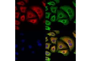 TAP1 Antibody staining Hela cells by IF/ICC.