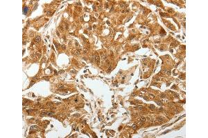 Immunohistochemistry (IHC) image for anti-Transforming Growth Factor, beta Receptor 1 (TGFBR1) antibody (ABIN2426967) (TGFBR1 Antikörper)
