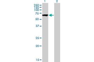 Western Blotting (WB) image for anti-Protein Phosphatase 2, Regulatory Subunit B, gamma (PPP2R2C) (AA 1-430) antibody (ABIN519121)
