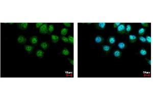 ICC/IF Image LIMD1 antibody [C2C3], C-term detects LIMD1 protein at cytoplasm and nucleus by immunofluorescent analysis. (LIMD1 Antikörper  (C-Term))