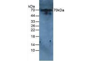 Detection of IL6R in Rat Liver Tissue using Polyclonal Antibody to Interleukin 6 Receptor (IL6R) (IL-6 Receptor Antikörper  (AA 385-462))
