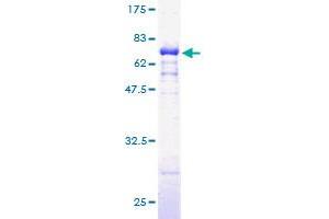 DHPS Protein (AA 1-369) (GST tag)