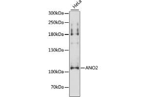 Western blot analysis of extracts of HeLa cells, using ANO2 antibody (ABIN6291635) at 1:3000 dilution. (Anoctamin 2 Antikörper)