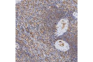 IHC analysis of Syntenin 2/SDCBP2 using anti-Syntenin 2/SDCBP2 antibody (ABIN7600017). (SDCBP2 Antikörper  (AA 14-292))