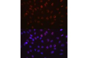 Immunofluorescence analysis of C6 cells using Aurora B antibody (ABIN7265782). (Aurora Kinase B Antikörper)
